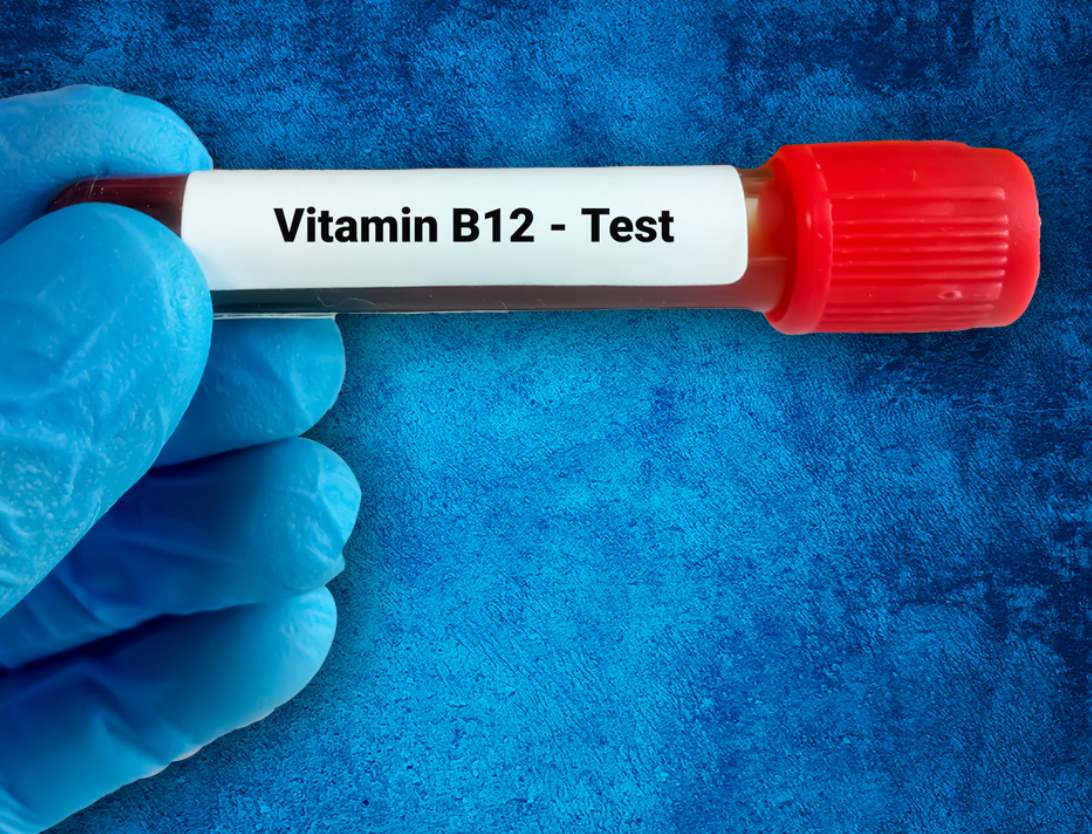 Symptômes Courants D’un Taux élevé de Vitamine B12 Dans le Sang : Causes, Effets Secondaires et Options de Traitement